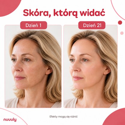Maska LED Lumio - Codzienny kwadrans dla Twojej skóry