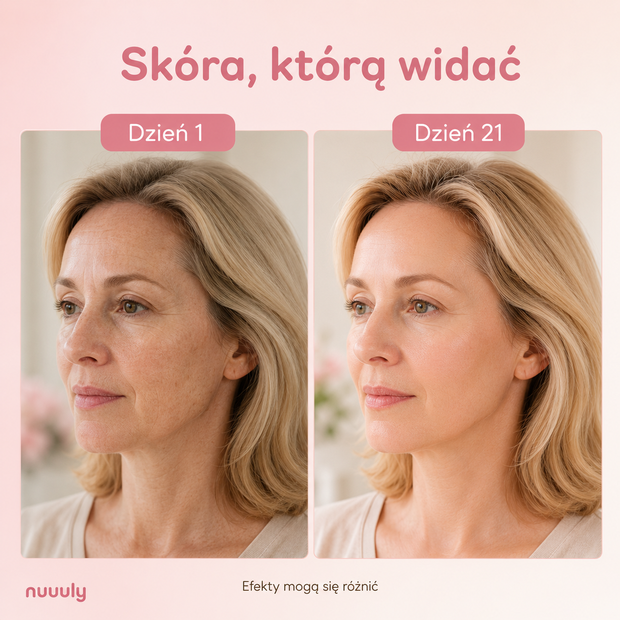Maska LED Lumio - Codzienny kwadrans dla Twojej skóry